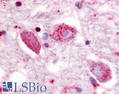 Anti-GPR85 antibody LS-A341 IHC of human putamen, neurons. Immunohistochemistry of formalin-fixed, paraffin-embedded tissue after heat-induced antigen retrieval.
