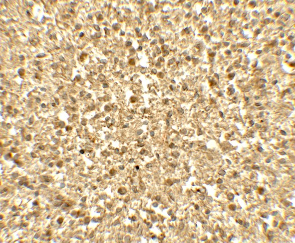 Immunohistochemistry of SREBF1 in human spleen tissue with SREBF1 antibody at 5 ug/mL.