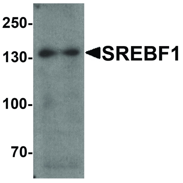 Western blot analysis of SREBF1 in Daudi cell lysate with SREBF1 antibody at 1 ug/ml.