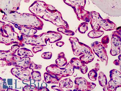 Anti-SREBP-2 antibody IHC of human placenta. Immunohistochemistry of formalin-fixed, paraffin-embedded tissue after heat-induced antigen retrieval. Antibody LS-B1002 concentration 2.5 ug/ml.