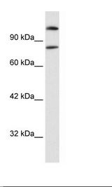 Raji Cell Lysate