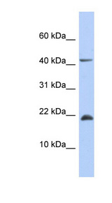 SREK1IP1 / SFRS12IP1 antibody LS-C111690 Western blot of Fetal Muscle lysate.
