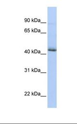 HepG2 cell lysate. Antibody concentration: 1.0 ug/ml. Gel concentration: 12%.