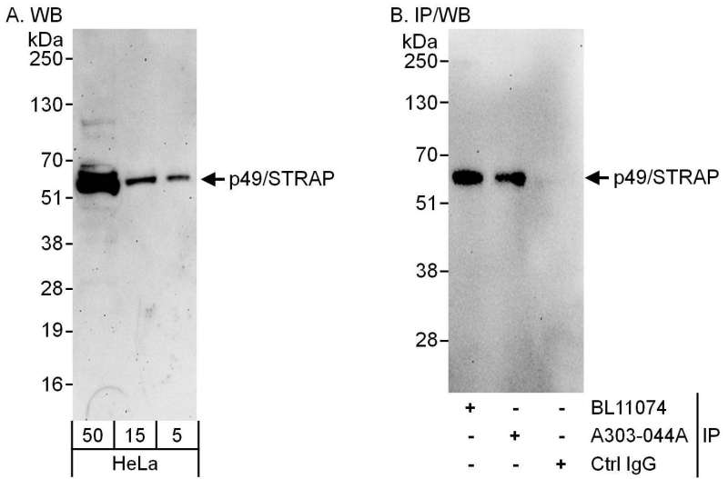 Detection of Human p49/STRAP by Western Blot and Immunoprecipitation. Samples: Whole cell lysate (5, 15 and 50 ug for WB; 1 mg for IP, 20% of IP loaded) from HeLa cells. Antibodies: Affinity purified rabbit anti-p49/STRAP antibody used for WB at 0.4 ug/ml (A) and 1 ug/ml (B) and used for IP at 6 ug/mg lysate. p49/STRAP was also immunoprecipitated by rabbit anti-p49/STRAP antibody BL11074, which recognizes an upstream epitope. Detection: Chemiluminescence with exposure times of 3 minutes (A) and 10 seconds (B).