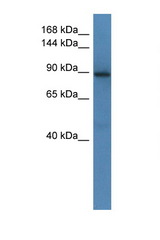 SRGAP1 antibody LS-C135447 Western blot of Mouse Brain lysate. Antibody concentration 1 ug/ml.