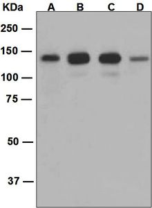 Western blot analysis on (A) mouse brain, (B) SH-SY5Y, (C) 293T, and (D) JAR lysates using anti-srGAP2 antibody.
