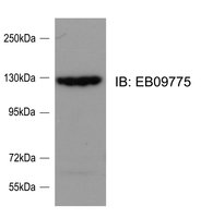 SRGAP2 antibody (0.1 ug/ml) staining of Rat Cortical Neuron lysate (35 ug protein/ml in RIPA buffer). Primary incubation was 1 hour. Detected by chemiluminescence.
