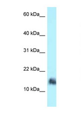 SRGN antibody LS-C146031 Western blot of Jurkat Cell lysate. Antibody concentration 1 ug/ml.