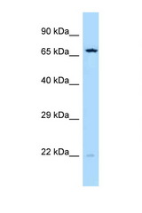 SRI antibody LS-C146026 Western blot of Jurkat Cell lysate. Antibody concentration 1 ug/ml.