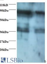 Western blot of spermidine synthase antibody at 2 ug/ml. Lane 1: EC109 whole cell lysate. Lane 2: 293T whole cell lysate. Secondary: Goat polyclonal to Rabbit IgG at 1:15000 dilution. Predicted band size: 33.2 kDa. Observed band size: 38 kDa Additional bands at: 80 kDa. We are unsure as to the identity of this extra band.