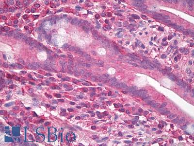 Anti-SRM / Spermidine Synthase antibody IHC staining of human small intestine. Immunohistochemistry of formalin-fixed, paraffin-embedded tissue after heat-induced antigen retrieval.