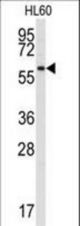Western blot of anti-SRMS Antibody in HL60 cell line lysates (35 ug/lane). SRMS(arrow) was detected using the purified antibody.