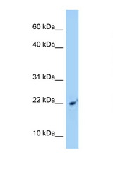 SRP14 antibody LS-C146198 Western blot of Jurkat Cell lysate. Antibody concentration 1 ug/ml.
