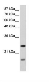 HepG2 Cell Lysate