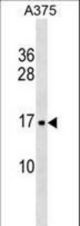 SRP14 Antibody western blot of A375 cell line lysates (35 ug/lane). The SRP14 antibody detected the SRP14 protein (arrow).