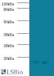 Western blot of Signal recognition particle 19 KDa protein antibody at 2 ug/ml lane 1: Jurkat whole cell lysate lane 2: HeLa whole cell lysate. Secondary: Goat polyclonal to Rabbit lgG at 1:15000 dilution. Predicted band size: 16 KDa. Observed band size: 16 KDa.