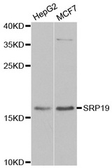 Western blot analysis of extracts of various cell lines, using SRP19 antibody.