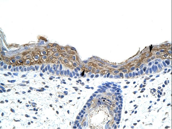 SRP19 antibody LS-C30570 was used in IHC to stain formalin-fixed, paraffin-embedded human skin.