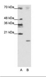 A: Marker, B: Jurkat Cell Lysate