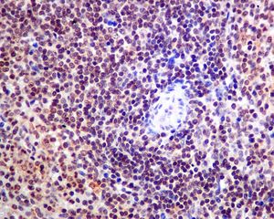 IHC of paraffin-embedded human spleen tissue using anti-SRP19 antibody.