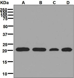 Western blot analysis on (A) Jurkat, (B) HeLa, (C) Daudi, and (D) HepG2 cell lysates using anti-SRP19 antibody.