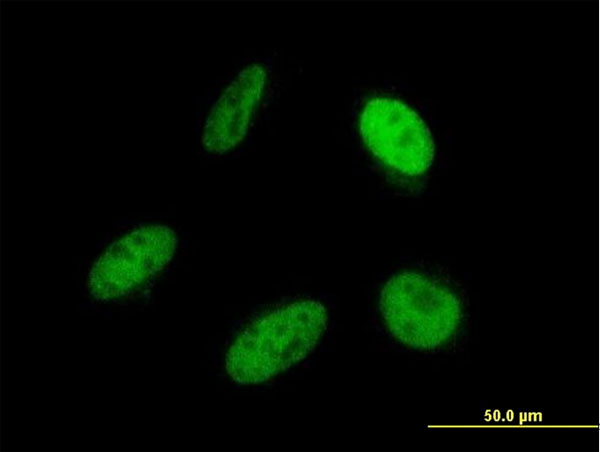 Immunofluorescence of monoclonal antibody to SRP68 on HeLa cell . [antibody concentration 10 ug/ml]