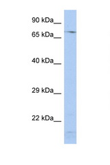 SRP72 antibody LS-C112309 Western blot of PANC1 Cell lysate. Antibody concentration 1 ug/ml.