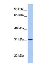 Hela cell lysate. Antibody concentration: 1.0 ug/ml. Gel concentration: 12%.