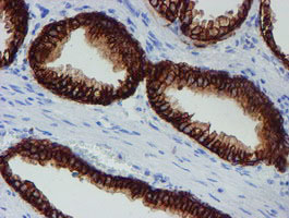 IHC of paraffin-embedded Human prostate tissue using anti-SRPRB mouse monoclonal antibody.
