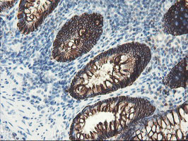 IHC of paraffin-embedded Human colon tissue using anti-SRPRB mouse monoclonal antibody.