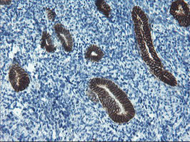 IHC of paraffin-embedded Human endometrium tissue using anti-SRPRB mouse monoclonal antibody.