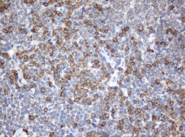 IHC of paraffin-embedded Human lymphoma tissue using anti-SRPRB mouse monoclonal antibody.