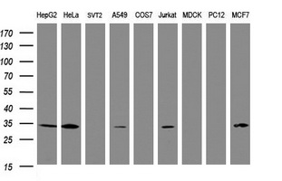 Western blot of extracts (35 ug) from 9 different cell lines by using g anti-SRPRB monoclonal antibody (HepG2: human; HeLa: human; SVT2: mouse; A549: human; COS7: monkey; Jurkat: human; MDCK: canine; PC12: rat; MCF7: human).