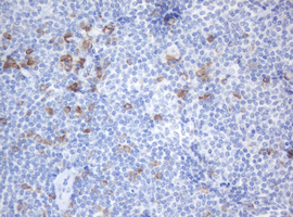 IHC of paraffin-embedded Human lymphoma tissue using anti-SRPRB mouse monoclonal antibody. (Heat-induced epitope retrieval by 10mM citric buffer, pH6.0, 120°C for 3min).