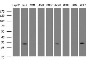 Western blot of extracts (35ug) from 9 different cell lines by using anti-SRPRB monoclonal antibody (HepG2: human; HeLa: human; SVT2: mouse; A549: human; COS7: monkey; Jurkat: human; MDCK: canine; PC12: rat; MCF7: human).