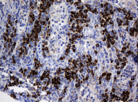 IHC of paraffin-embedded Human lymph node tissue using anti-SRPRB mouse monoclonal antibody.