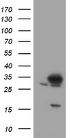 HEK293T cells were transfected with the pCMV6-ENTRY control (Left lane) or pCMV6-ENTRY SRPRB (Right lane) cDNA for 48 hrs and lysed. Equivalent amounts of cell lysates (5 ug per lane) were separated by SDS-PAGE and immunoblotted with anti-SRPRB.