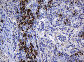 IHC of paraffin-embedded Human lymph node tissue using anti-SRPRB mouse monoclonal antibody. (Heat-induced epitope retrieval by 10mM citric buffer, pH6.0, 120°C for 3min).