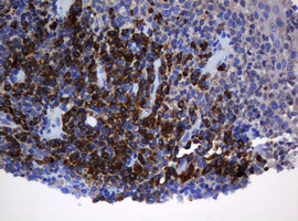 IHC of paraffin-embedded Human tonsil using anti-SRPRB mouse monoclonal antibody. (Heat-induced epitope retrieval by 10mM citric buffer, pH6.0, 120°C for 3min).