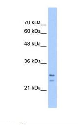 HepG2 cell lysate. Antibody concentration: 5.0 ug/ml. Gel concentration: 12%.