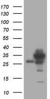 HEK293T cells were transfected with the pCMV6-ENTRY control (Left lane) or pCMV6-ENTRY SRPRB (Right lane) cDNA for 48 hrs and lysed. Equivalent amounts of cell lysates (5 ug per lane) were separated by SDS-PAGE and immunoblotted with anti-SRPRB.