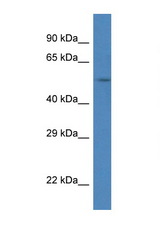 SRPX antibody LS-C145244 Western blot of Mouse Liver lysate. Antibody concentration 1 ug/ml.