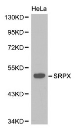 Western blot of SRPX pAb in extracts from Hela cells.