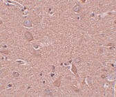 Immunohistochemistry of formalin-fixed, paraffin-embedded human brain stained with Rabbit anti-Human SRPX1 following heat mediated antigen retrieval using sodium citrate buffer (pH6.0)