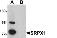 Western blot of SK-N-SH human neuroblastoma cell lysate probed with Rabbit anti-Human SRPX1