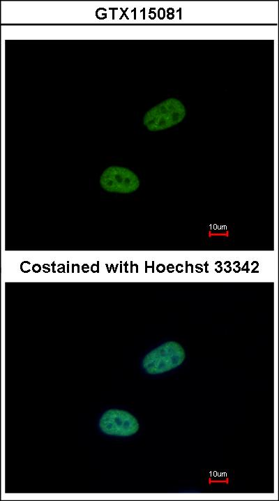 Immunofluorescence of paraformaldehyde-fixed HeLa using SRPX antibody at 1:500 dilution.