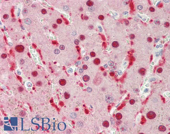 Human Liver: Formalin-Fixed, Paraffin-Embedded (FFPE)