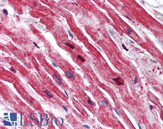 Anti-SRPX antibody IHC of human heart. Immunohistochemistry of formalin-fixed, paraffin-embedded tissue after heat-induced antigen retrieval. Antibody LS-B5049 concentration 5 ug/ml.