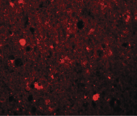 Immunofluorescence of SRPX1 in human brain tissue with SRPX1 antibody at 20 ug/ml.