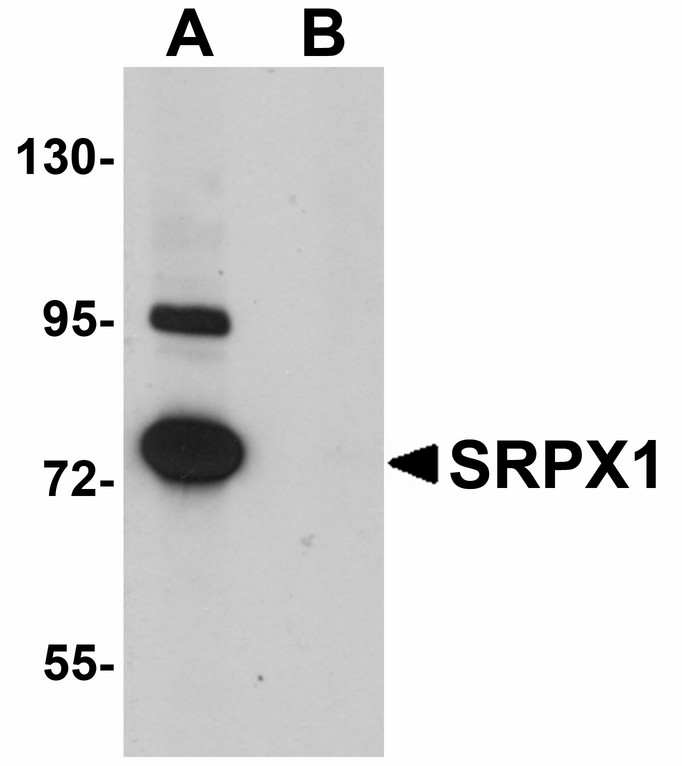 Western blot of SRPX1 in SK-N-SH cell lysate with SRPX1 antibody at 0.25 ug/ml in (A) the absence and (B) the presence of blocking peptide.